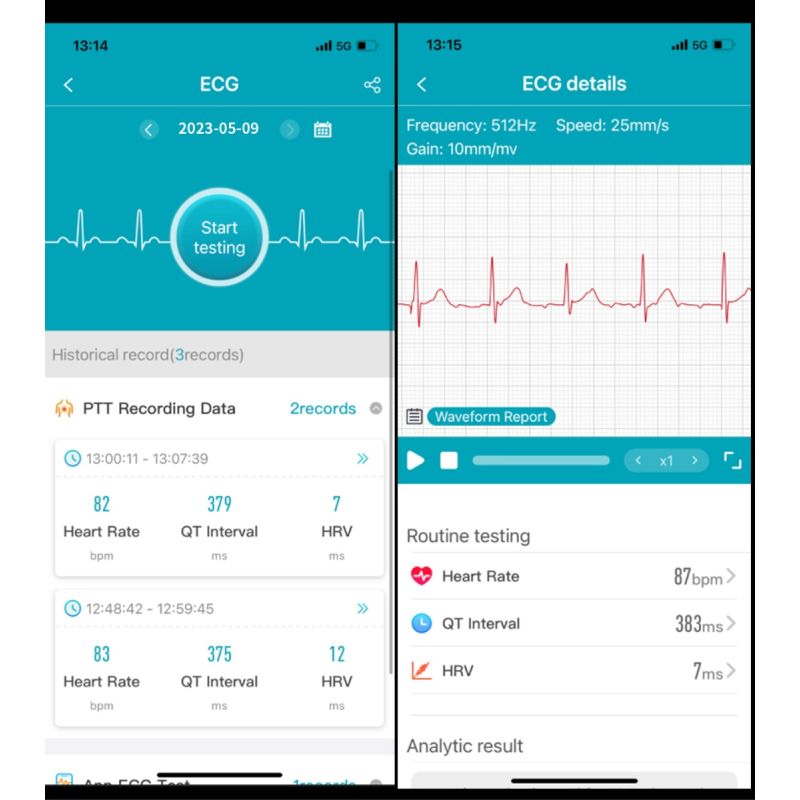 ET540 Glukoza/EKG Smartwatch Fitness Tracker: BT Połączenia, Tętno, Ciśnienie, Temp., Tlen, Całodobowe Monitorowanie dla Zdrowia